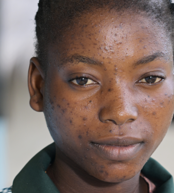 Un camino para salir de la pobreza en Zambia